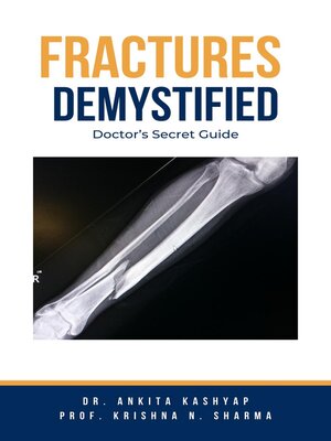 cover image of Fractures Demystified